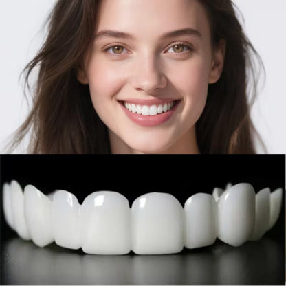 Facetas Dentárias Removíveis SorrisoFlex