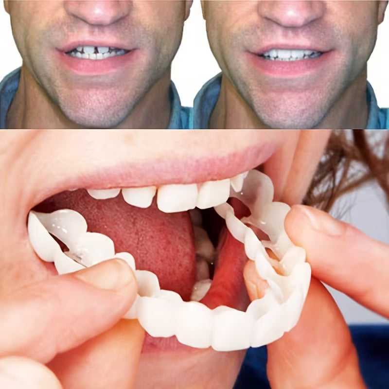Facetas Dentárias Removíveis SorrisoFlex