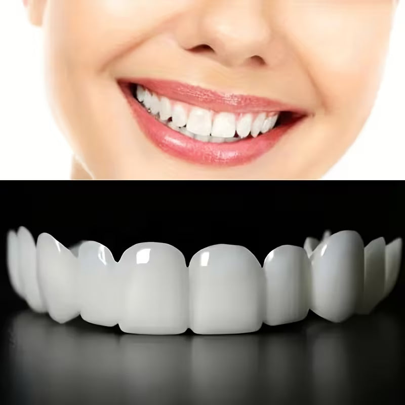 Facetas Dentárias Removíveis SorrisoFlex
